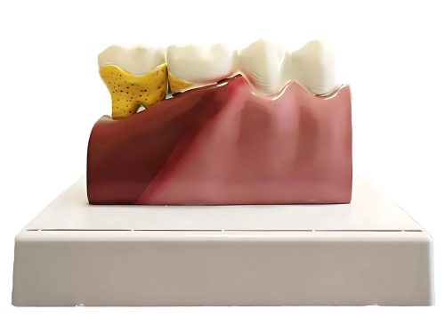 Anatomický model zuba a prierez čeľuste s vyberateľným zubom, 18 × 11 cm